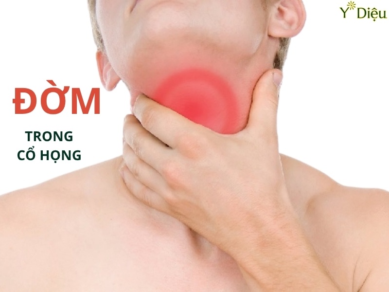 Đờm tích tụ trong cổ họng gây nhiều phền toái khó chịu